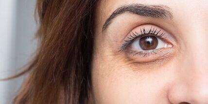 Serviço de Camuflagem de olheiras - tatuagem inaparente